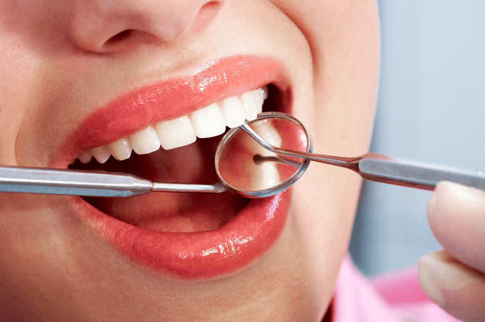 Restorative Dentistry | Preferred Family Dental | Dentists in Bedford, NH